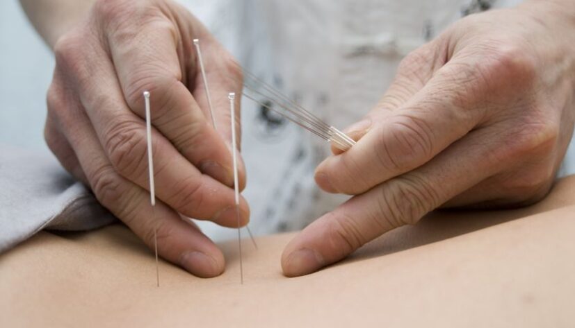 Akupunktur als Angebot in meiner Praxis für Traditionelle Chinesische Medizin (TCM) in Chur - Graubünden